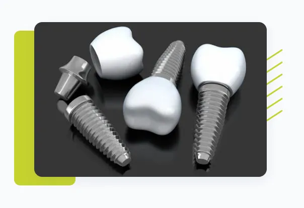 Specialised in Implantology